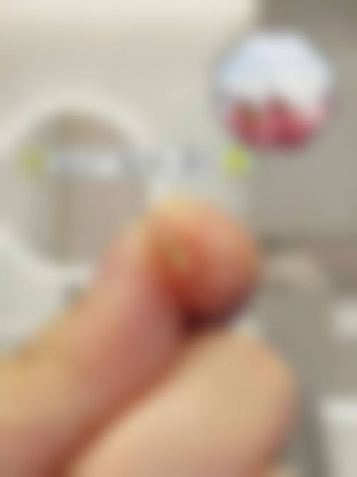 惠阳蓝芽口腔门诊部精良设备与安心诊疗保护