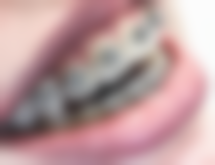 广西防城港廖慧敏口腔科来院指引