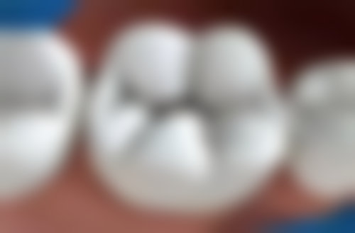 惠州市惠阳区粤口口腔门诊部