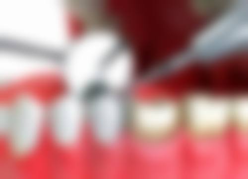 广东深圳钟伟科口腔诊所设备与技术优势