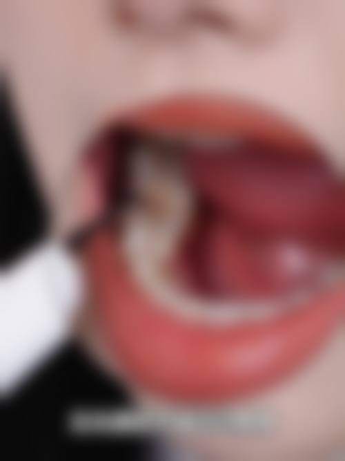 遵义汇川区华美口腔门诊部患者真实评价