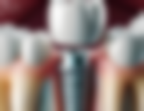 广东深圳钟伟科口腔诊所收费标准与价格参考