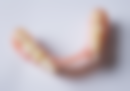 云南省第三人民医院口腔科特色诊疗技术