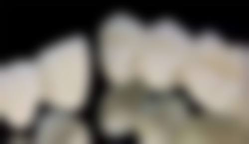 浙江宁波余姚维康口腔收费标准