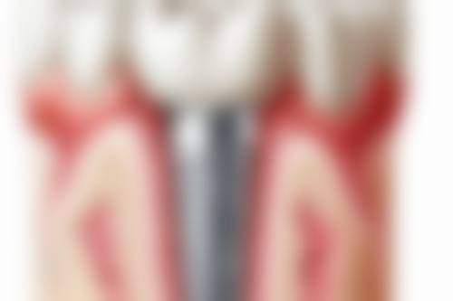 慈溪虎啸口腔来院指引