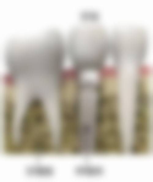 维尔口腔医院（甘露园分院）特色诊疗技术