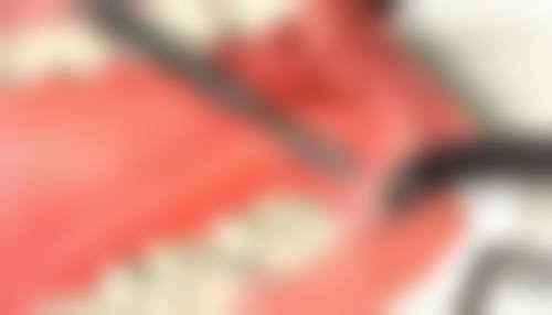 北京华烨新北口腔西北旺口腔技术优势