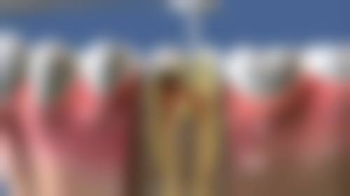 吴华伟的临床实战与个性化方案