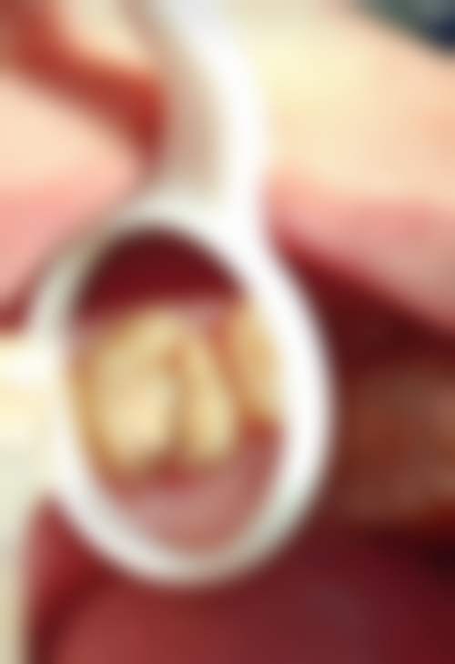 甘肃庆阳王建口腔诊所患者真实评价