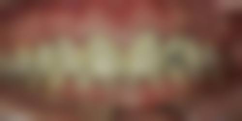 湖南长沙映日口腔的来院指引