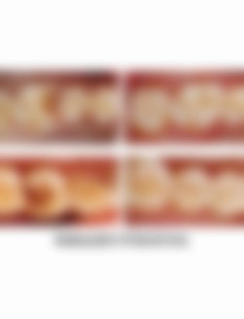 湖南长沙映日口腔的特色诊疗项目