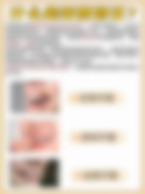 山东威海吉祥口腔患者真实评价