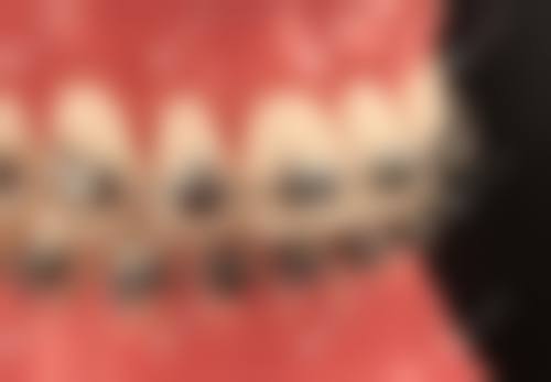 张国明的临床实战与个性化方案