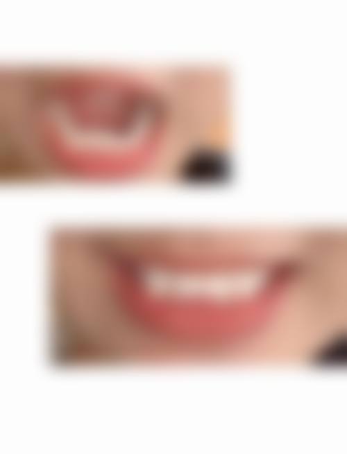 贵州贵阳林陈朗朗口腔医院收费价格参考