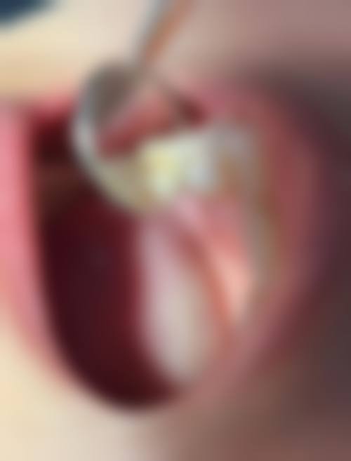 贵州毕节（遵义）京州口腔收费价格参考