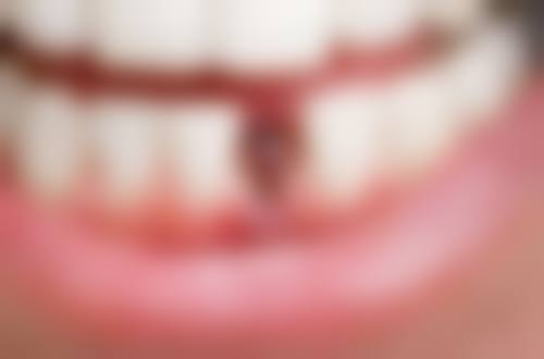 浙江嘉兴宏高口腔诊所患者真实评价