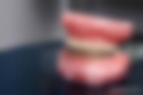 固原毛燕妮口腔门诊部特色诊疗技术