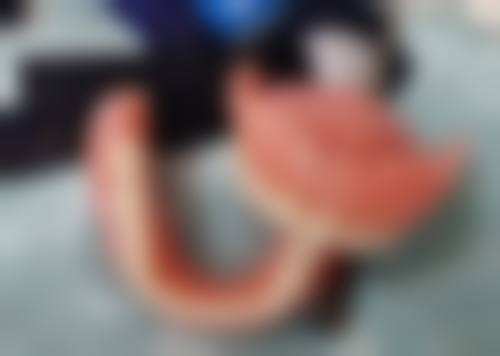 中山市人民医院口腔粘膜病科诊疗范围与技术实力