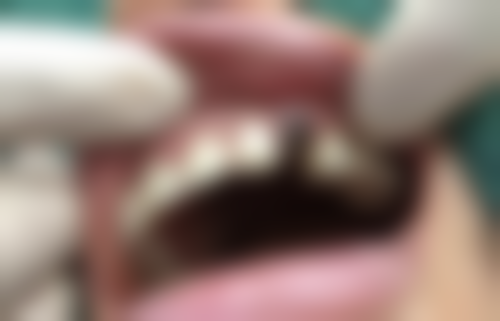 山东济南奥齿口腔来院指引