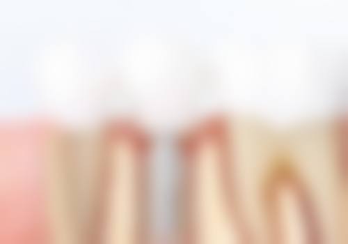 广东深圳华霆口腔患者真实评价