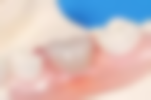 湖南长沙吴汉斌口腔医生团队实力