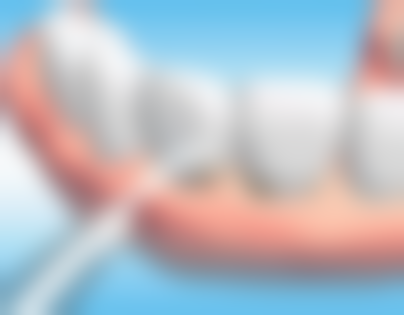 张可娟的临床实战与个性化方案