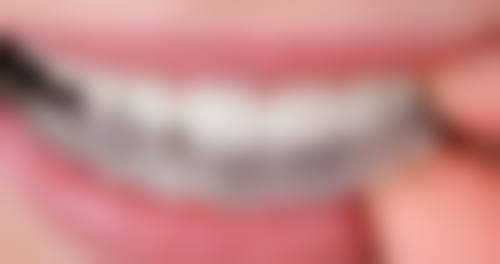 莆田市君正口腔门诊特色诊疗技术