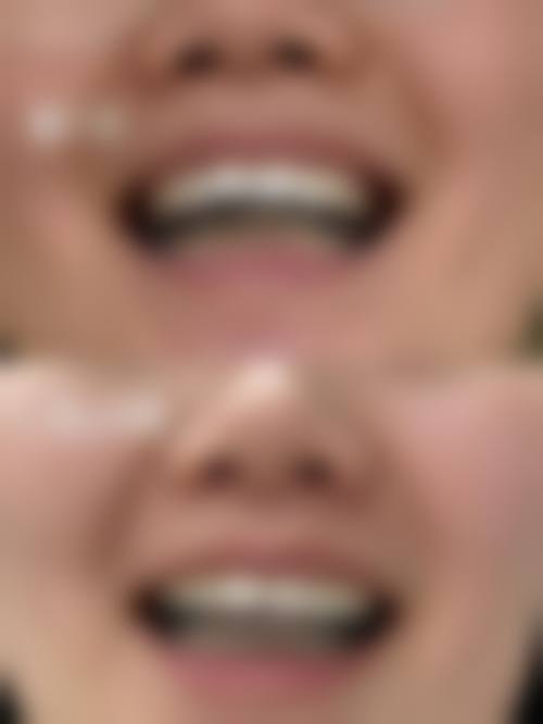 山东济南历下康宁口腔患者真实口碑