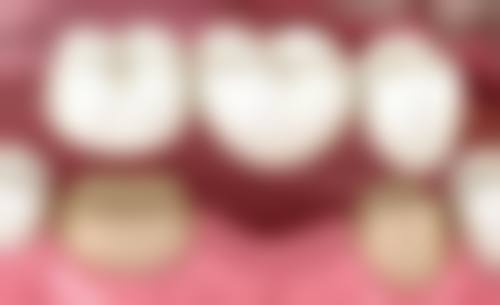 韩国江南SMILE VIEW牙科来院指引