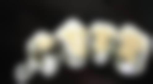 尹波的临床实战与个性化方案