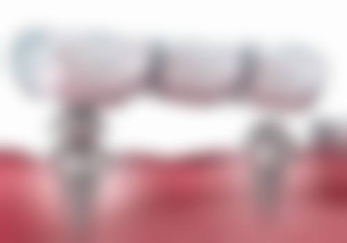 湘潭李让平口腔患者口碑