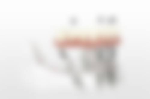 深圳笑倾城美学齿科特色诊疗技术