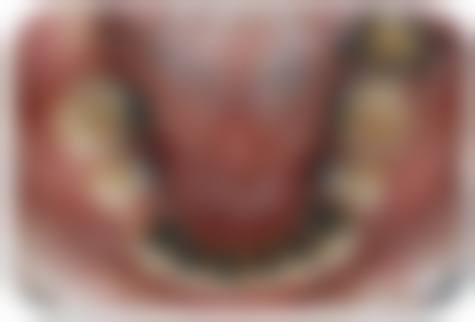 李惠的价格与坐诊指引