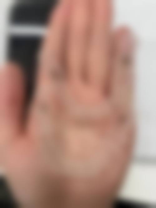 陕西西安莎莎口腔收费标准