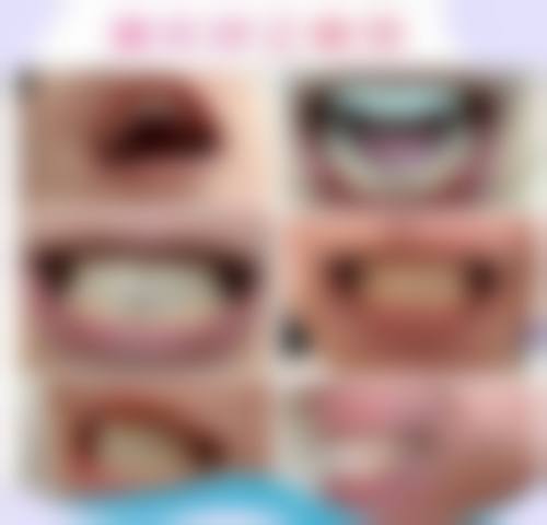 陕西西安莎莎口腔特色诊疗技术