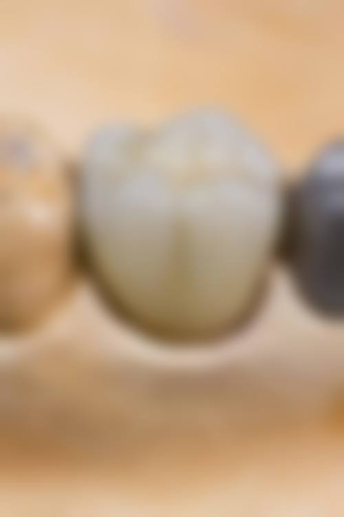 陕西西安莎莎口腔患者真实评价