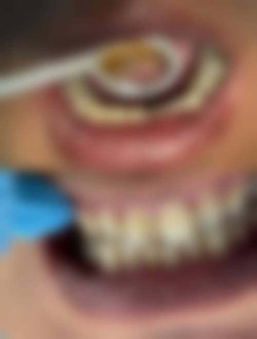 广东深圳缪裕达口腔诊所特色诊疗技术