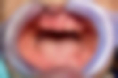 济南天桥金忠口腔收费价格参考