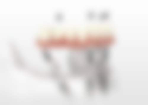 广东惠州安雅口腔特色诊疗项目