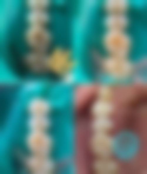 龙岩新罗宝佳口腔门诊部特色诊疗技术