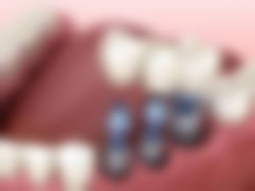 深圳沃思顿口腔门诊部交通路线攻略