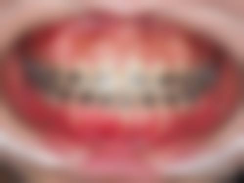 怀化市第一人民医院口腔科特色项目及技术优势