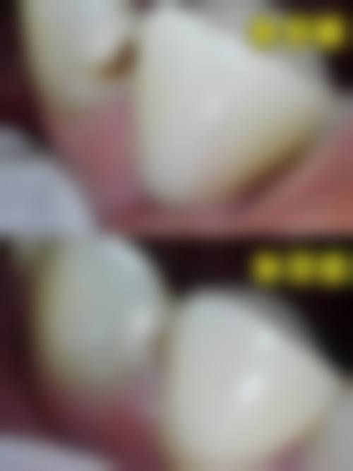 湖南益阳农垦口腔是正规的吗/怎么样/靠谱吗