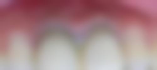 湖北咸宁万家口腔是正规的吗/怎么样/靠谱吗