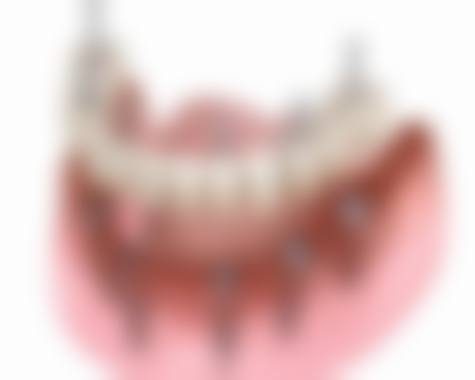 3. 高振阳的临床实战与真实实例