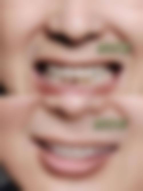 为什么要选择广东广州铭菲口腔?