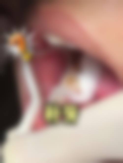 临沂兰山于德宝口腔诊所口碑怎么样