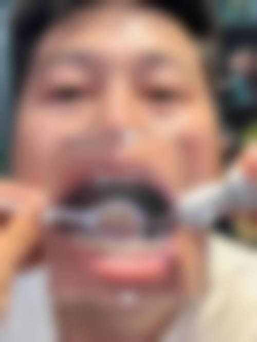 安徽安庆蓝天口腔怎么样预约挂号