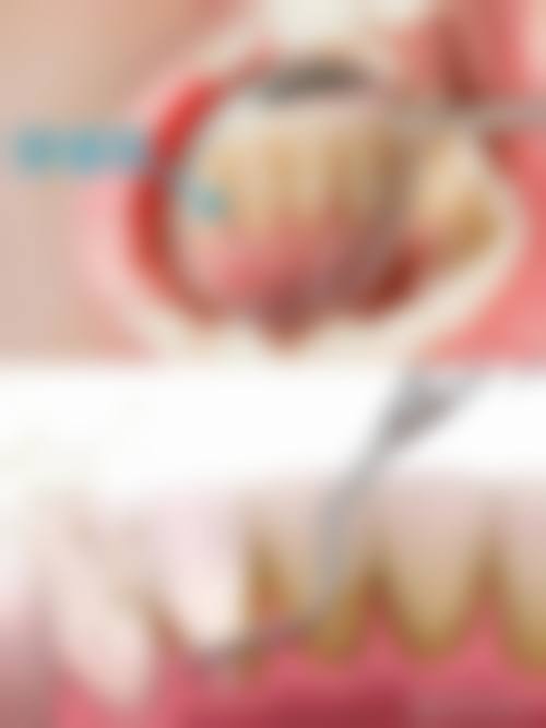 重庆美雅口腔特色项目及技术优势