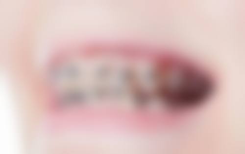 深圳百大联合口腔门诊部(南联分店)怎么样预约挂号